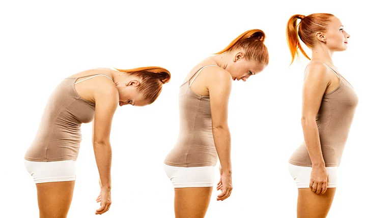 descenso de la lordosis cervical